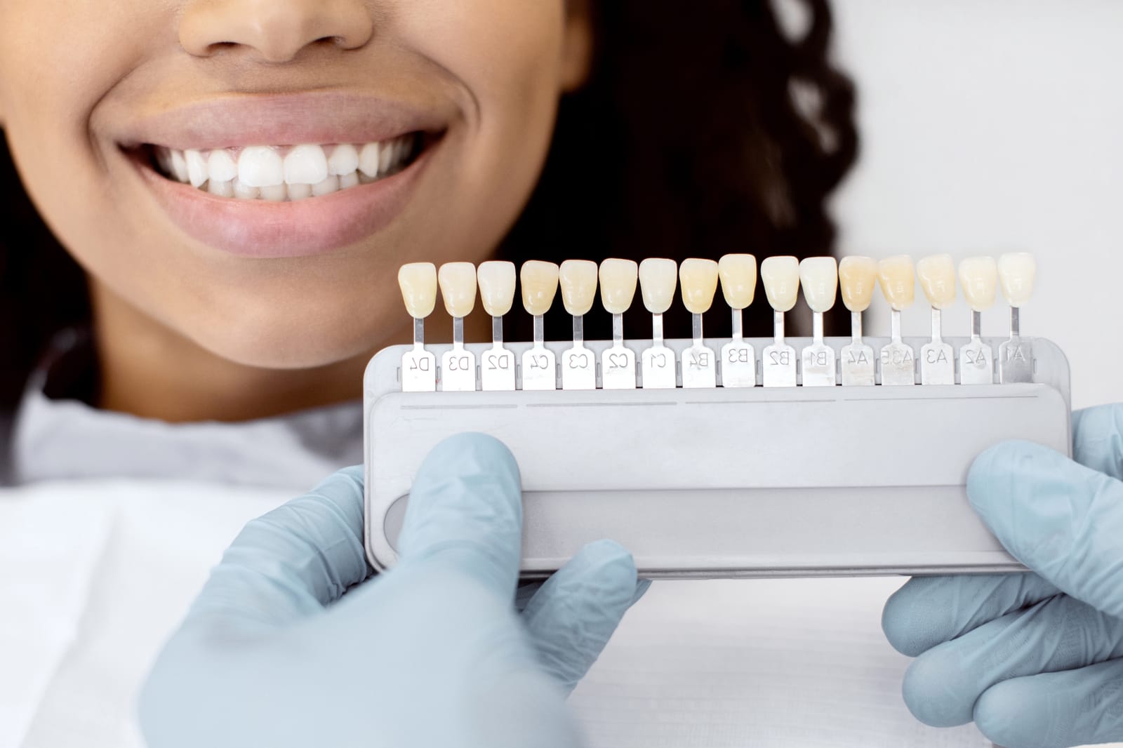 Discover safe, professional teeth whitening services at Save Dental. Book now to achieve a brighter smile and boost your confidence in St. George, Utah!