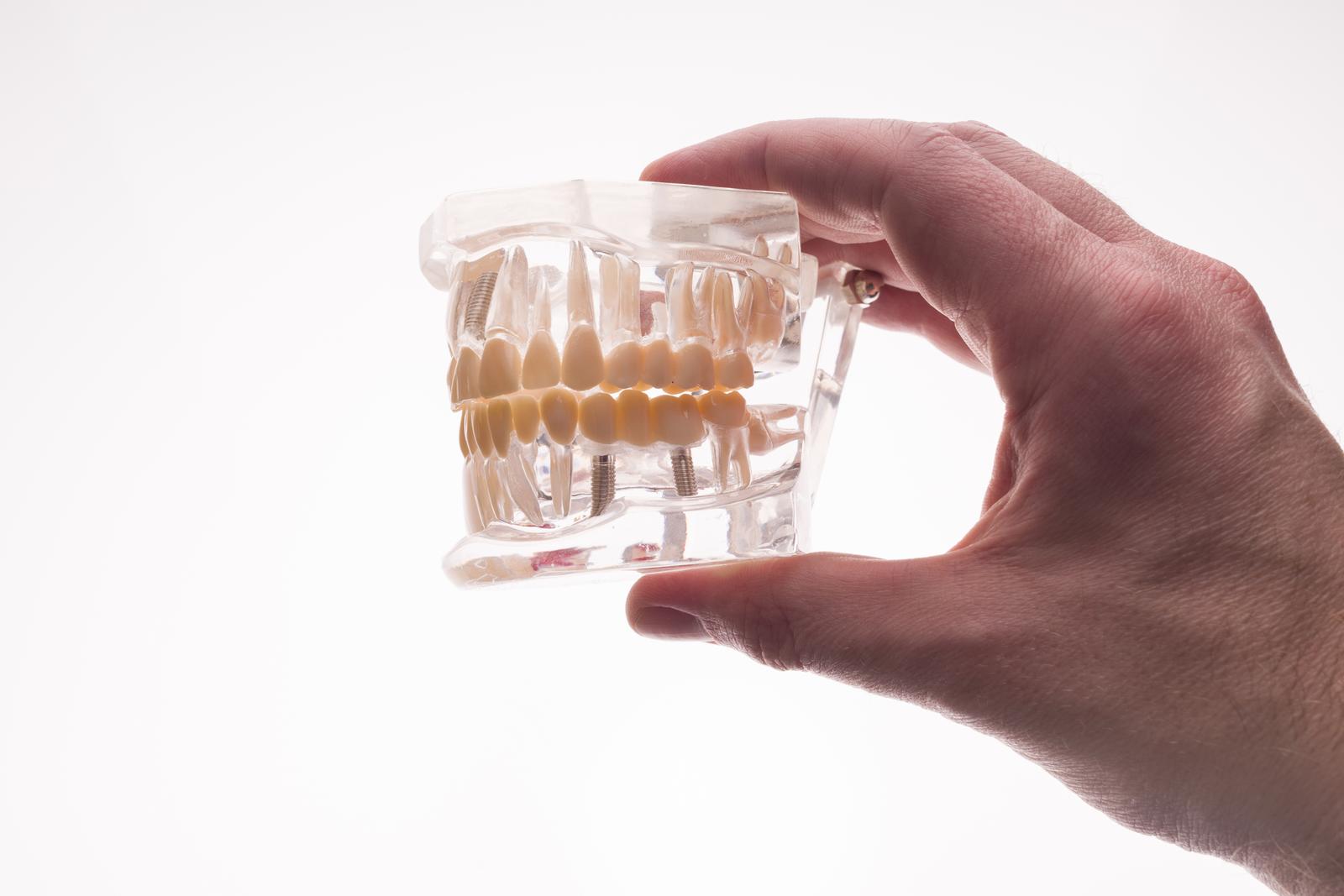 Dentist holding dentures jaw layout on a white background - image