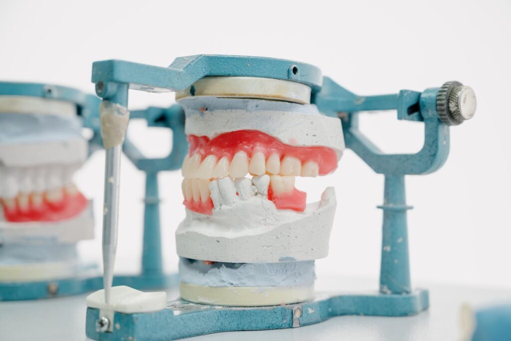 Production of dentures in a dental clinic.The process of creating dentures